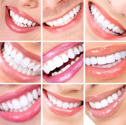 Odontología Cosmética En Las Vegas 1 Las Vegas Cosmetic Dentist