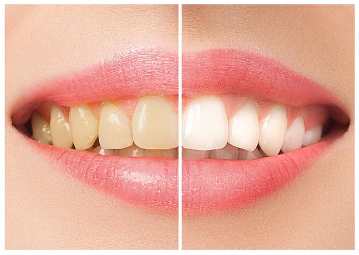 Conéctese Con Un Dentista De Unitedhealthcare 2 Cosmetic Dentistry